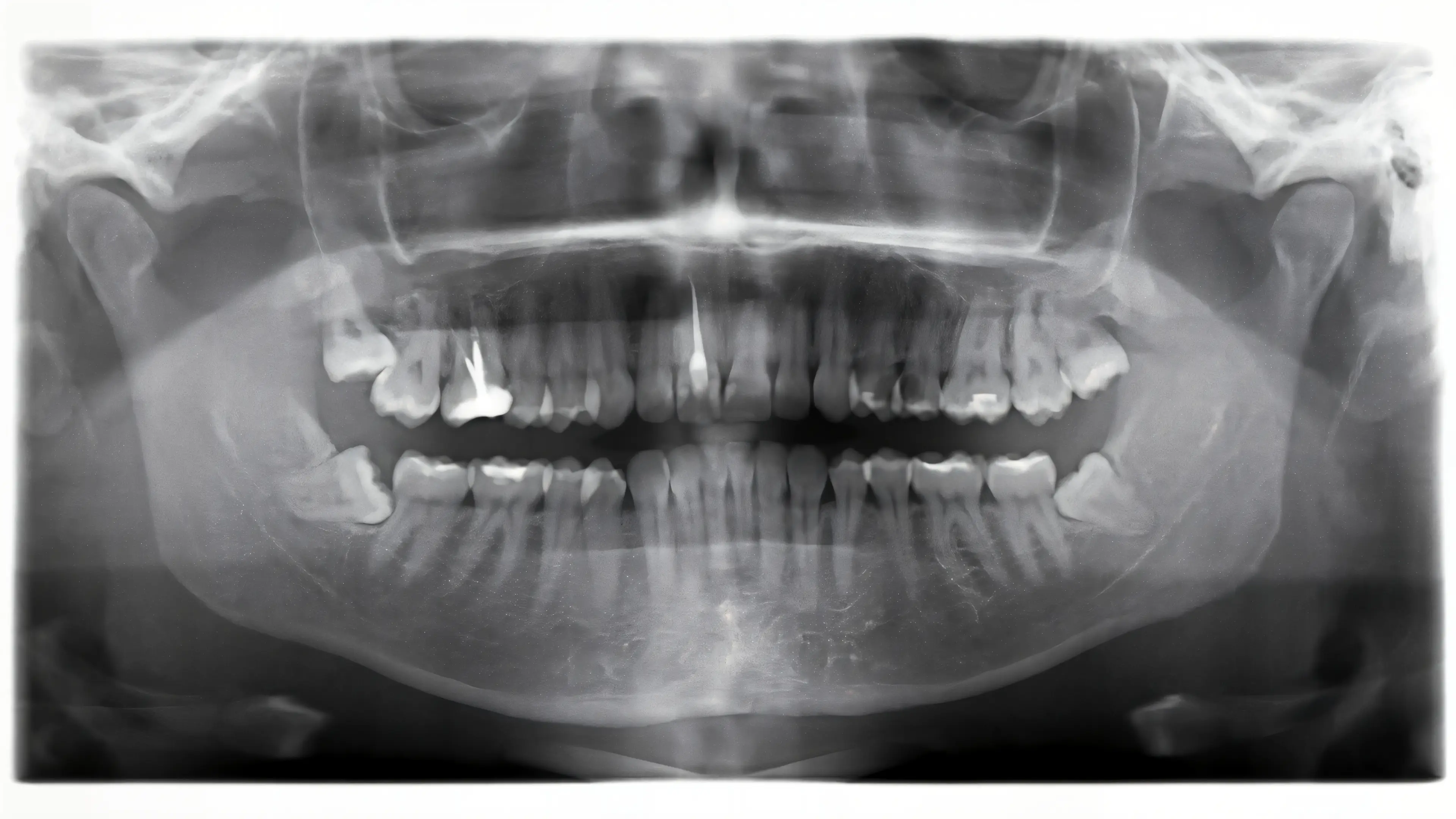 We've evolved not to need as large mouths or wisdom teeth, but some peoples still persist (Getty Stock Images) 