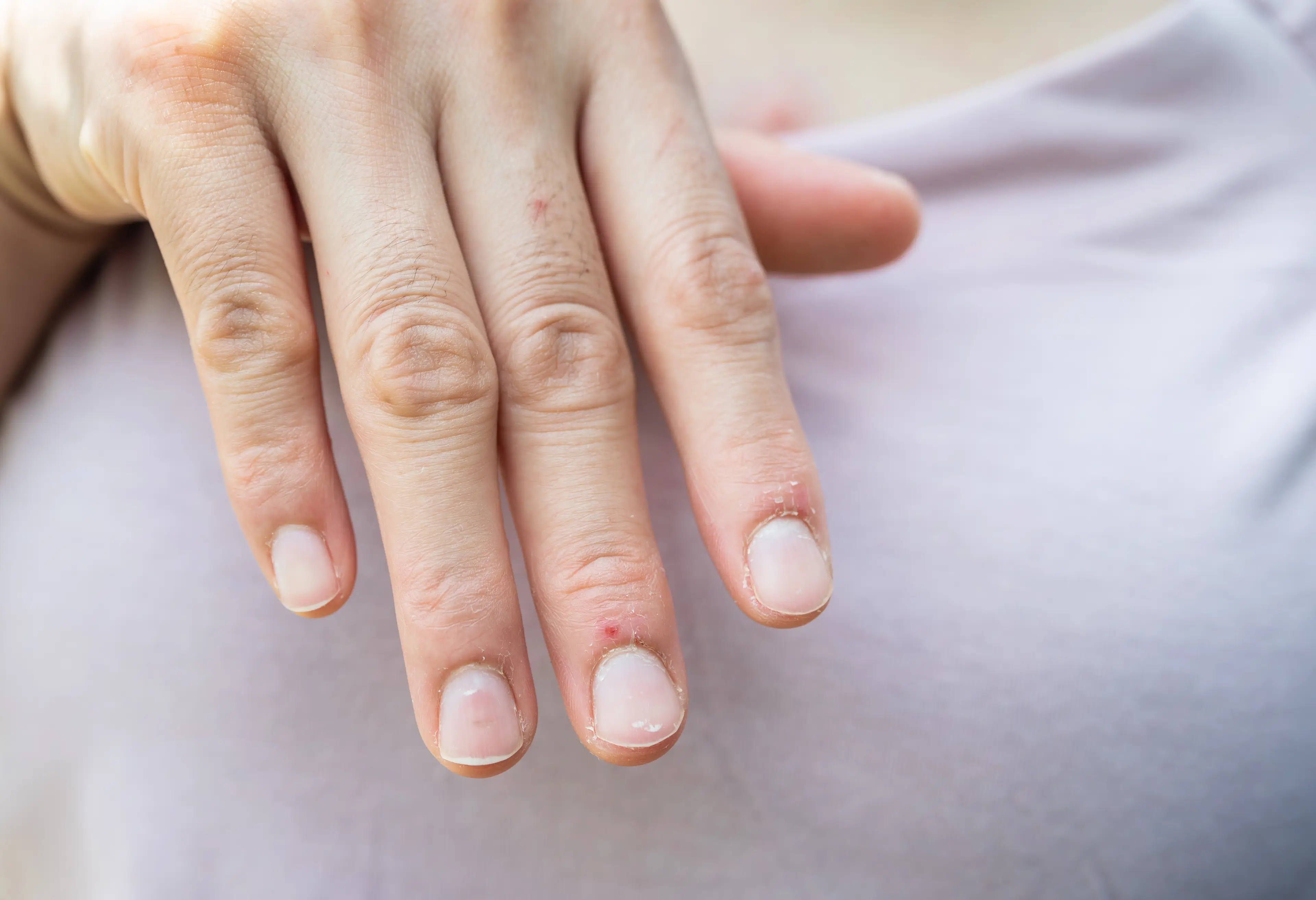 Your nails can show more about your health than you'd think (Getty Stock)