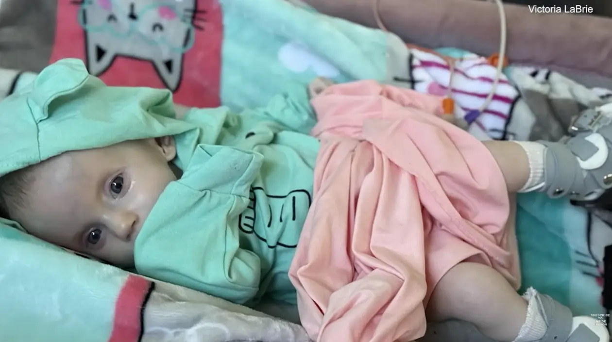 Hazel was born with Moebius syndrome (Inside Edition)