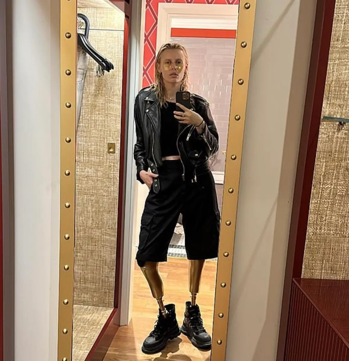 The model had her legs amputated because of TSS. (Instagram/@theimpossiblemuse)