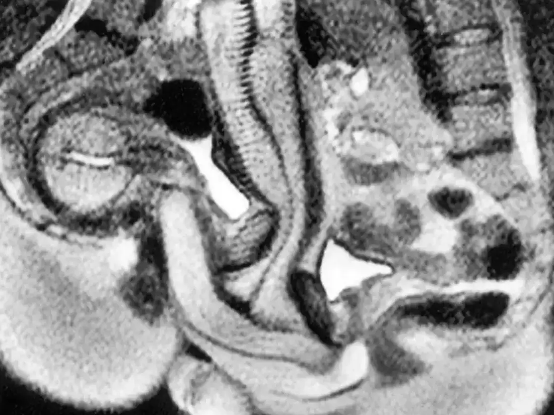 Only one couple were able to 'perform' inside the machine without Viagra (BMJ)