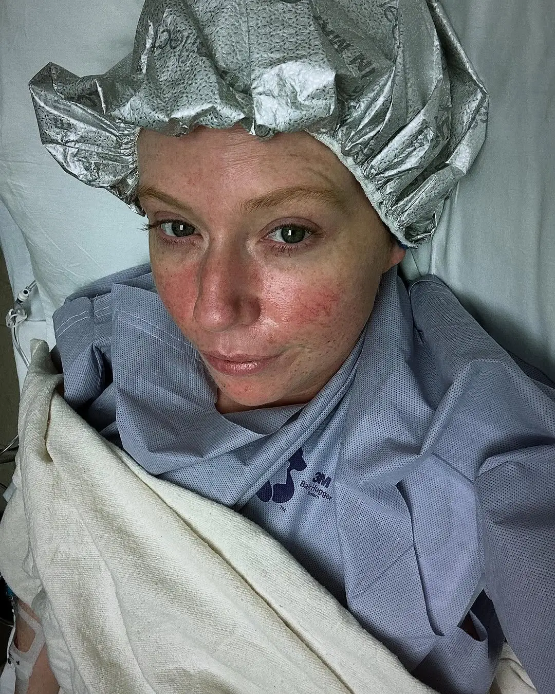 Beth had initially underwent chemo and radiation therapy (isthisriehlelife/Instagram)