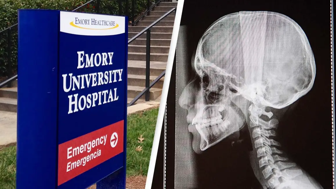 John E. Davidson/Getty Images / BSIP/Universal Images Group via Getty Images