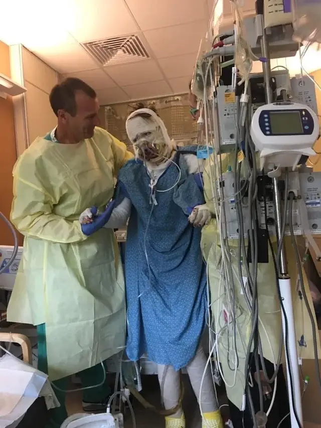 Abbey had to learn how to walk again (Reddit/abbeyiskewl2)