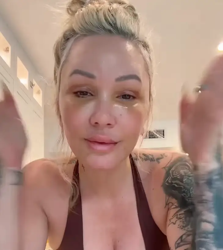 Bunnie Xo underwent the facelift after quitting filler (Instagram/@xomgitsbunnie)