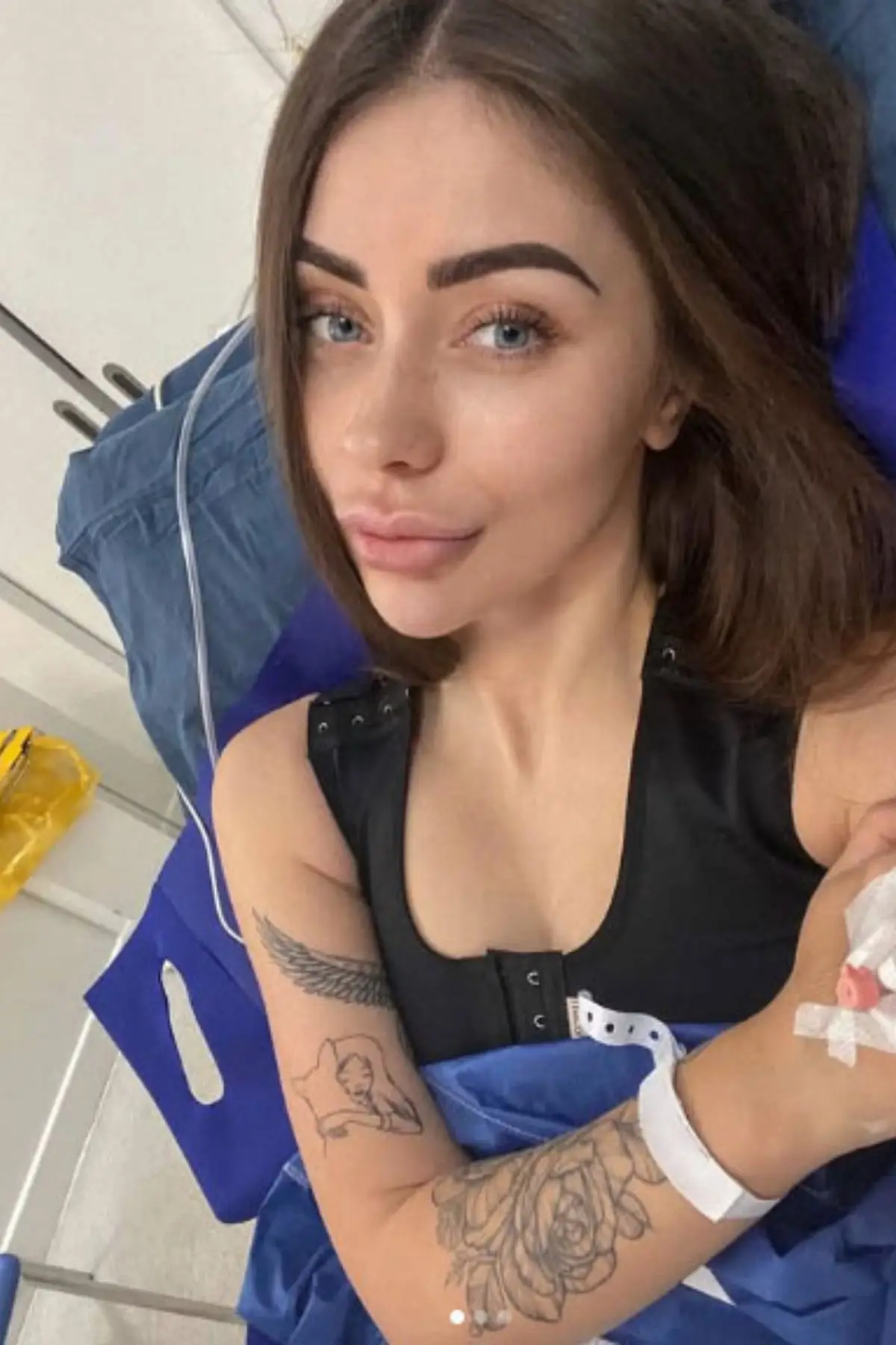 The woman, who has since moved back to Australia, had two corrective surgeries (Champion News)