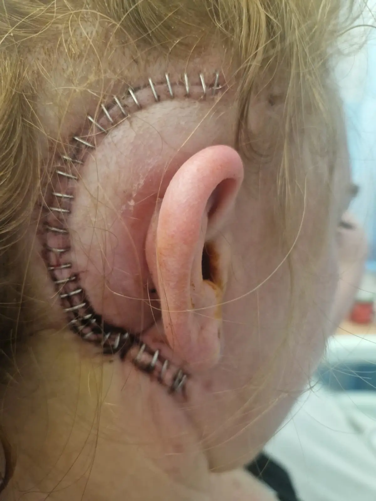 The 38-year-old had surgery last year (SWNS)