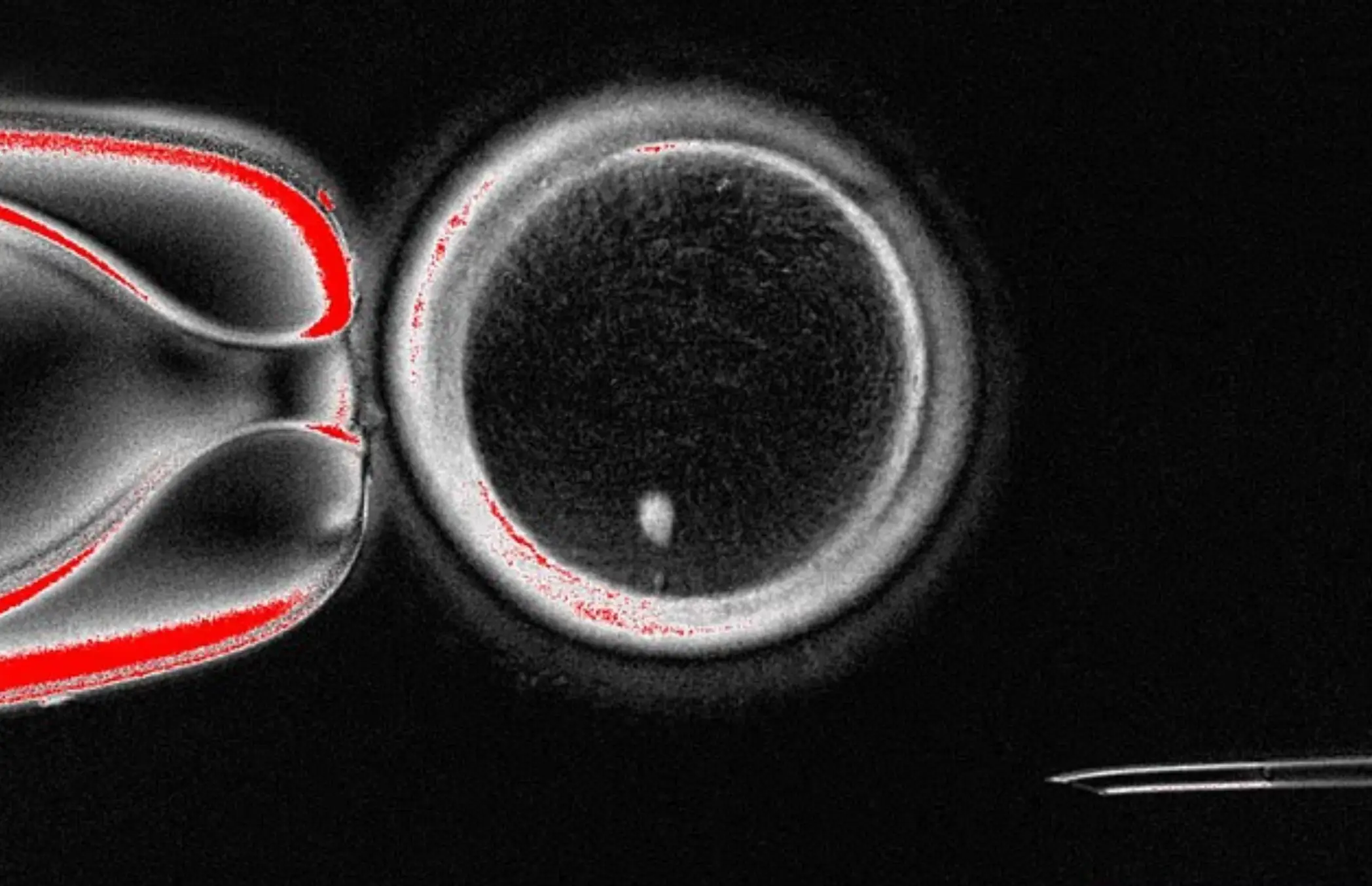 The embryos are made using the nucleus in skin cells (Mitalipov Laboratory)