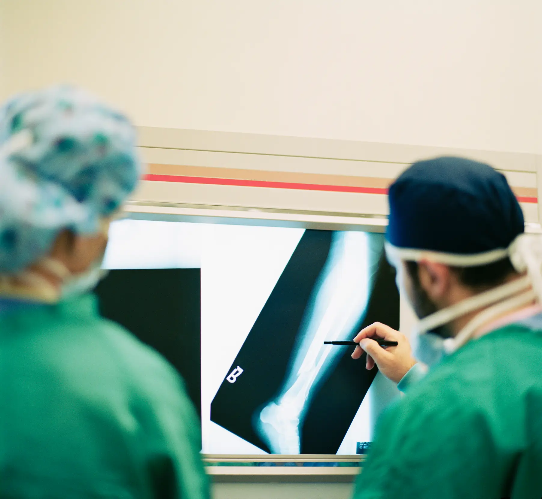 A broken bone will still need medical intervention (Getty Stock)