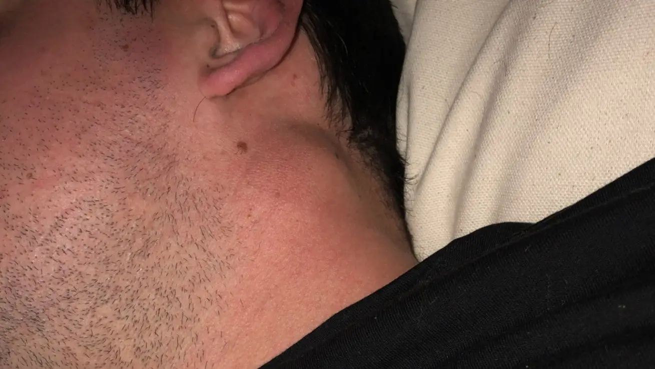 The lump was found when Lauren performed a safety check (Cover Images)