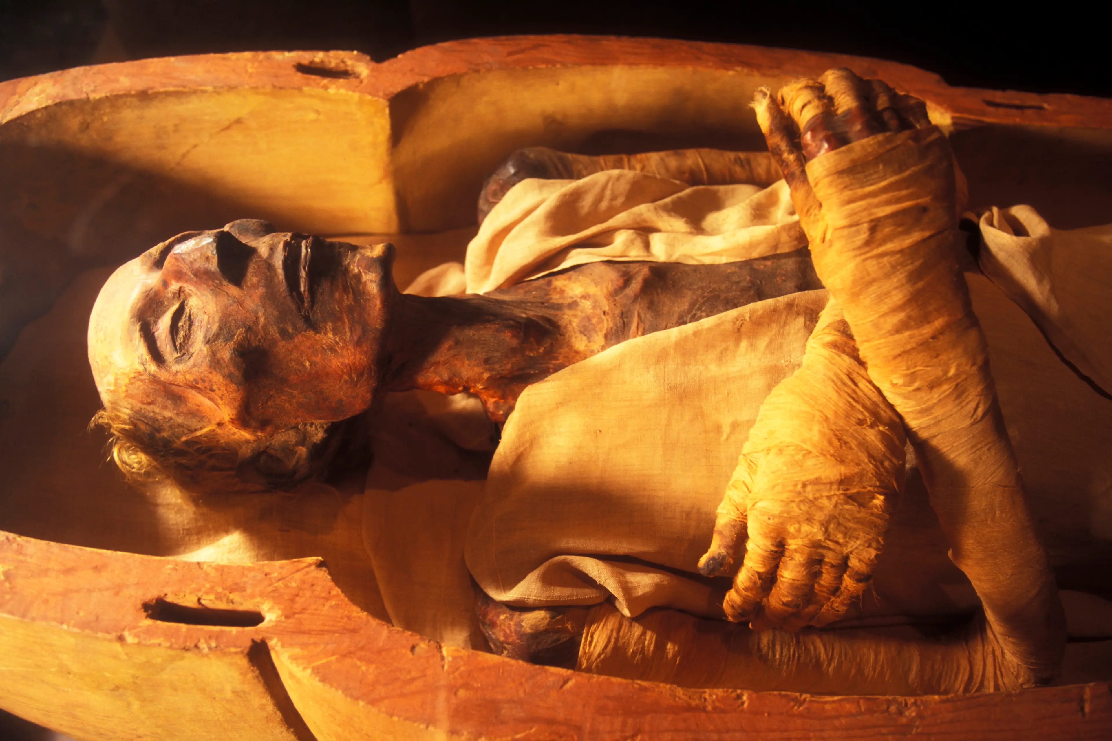The mummy of Ramesses II. (Patrick Landmann/Getty Images)