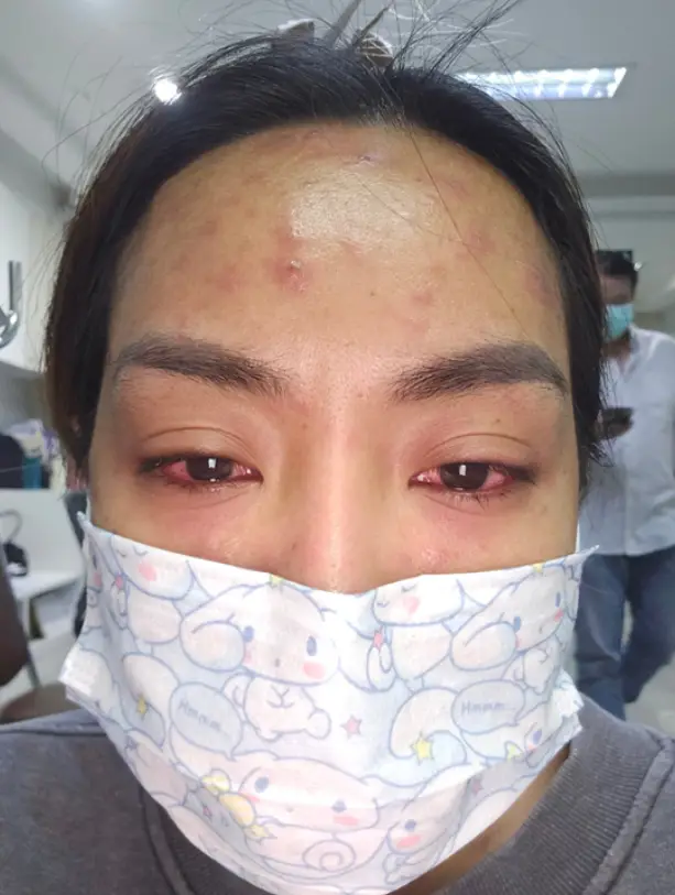 The model says the condition has 'shattered' her 'dream's (Viral Press)