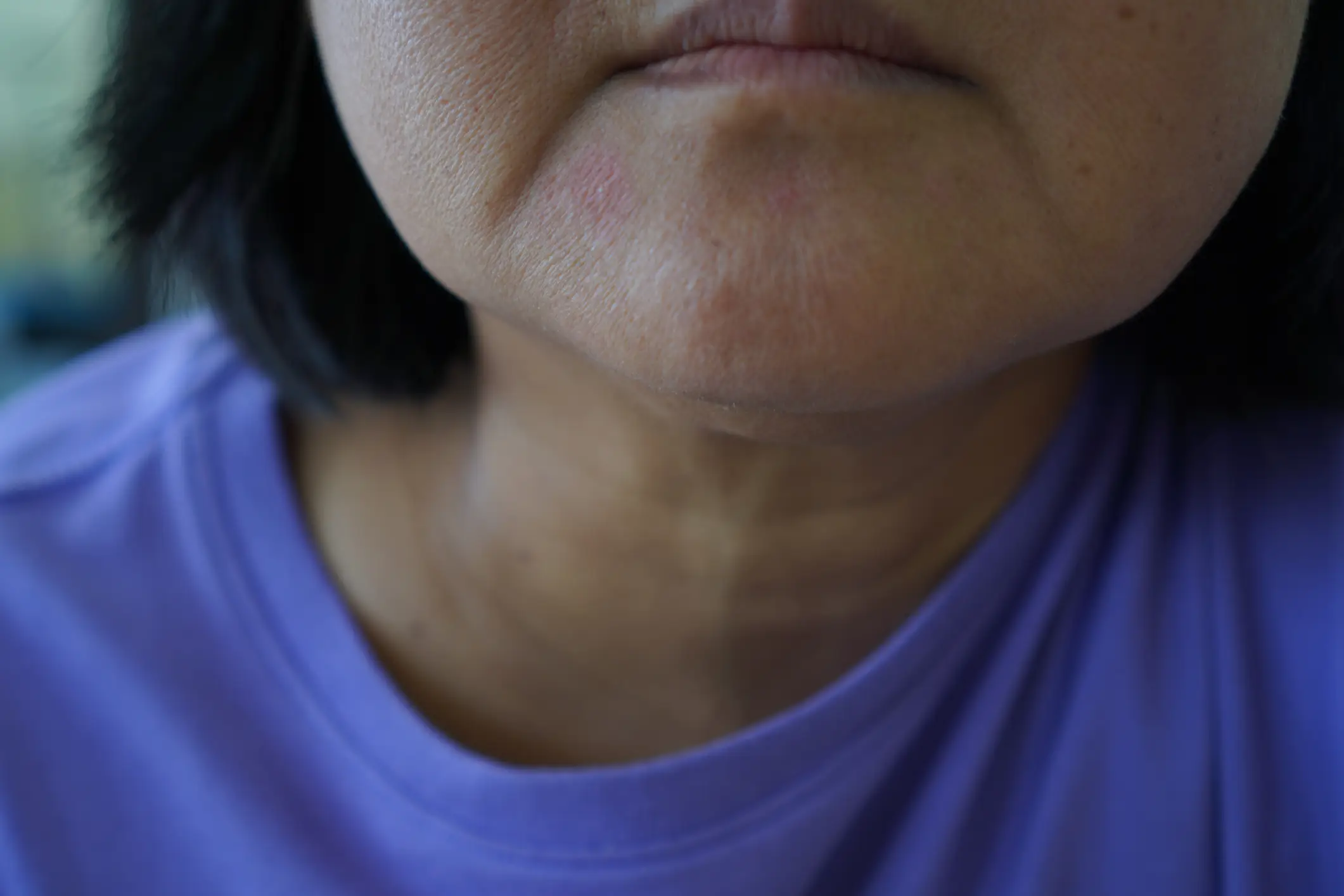 The mites are not visible (Getty Stock Photo)