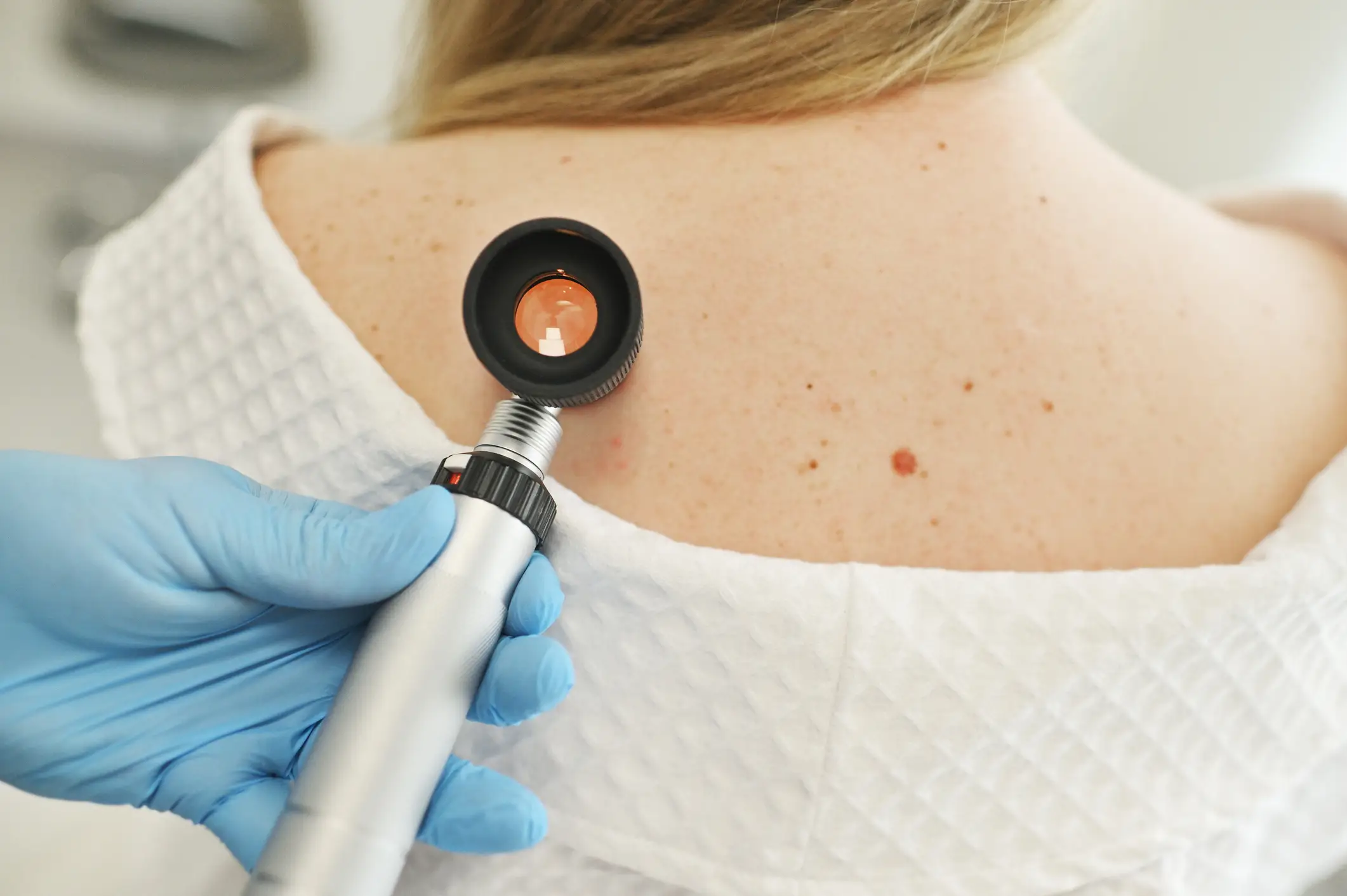 Skin cancer is one of the most common cancers in the US (Getty Images)