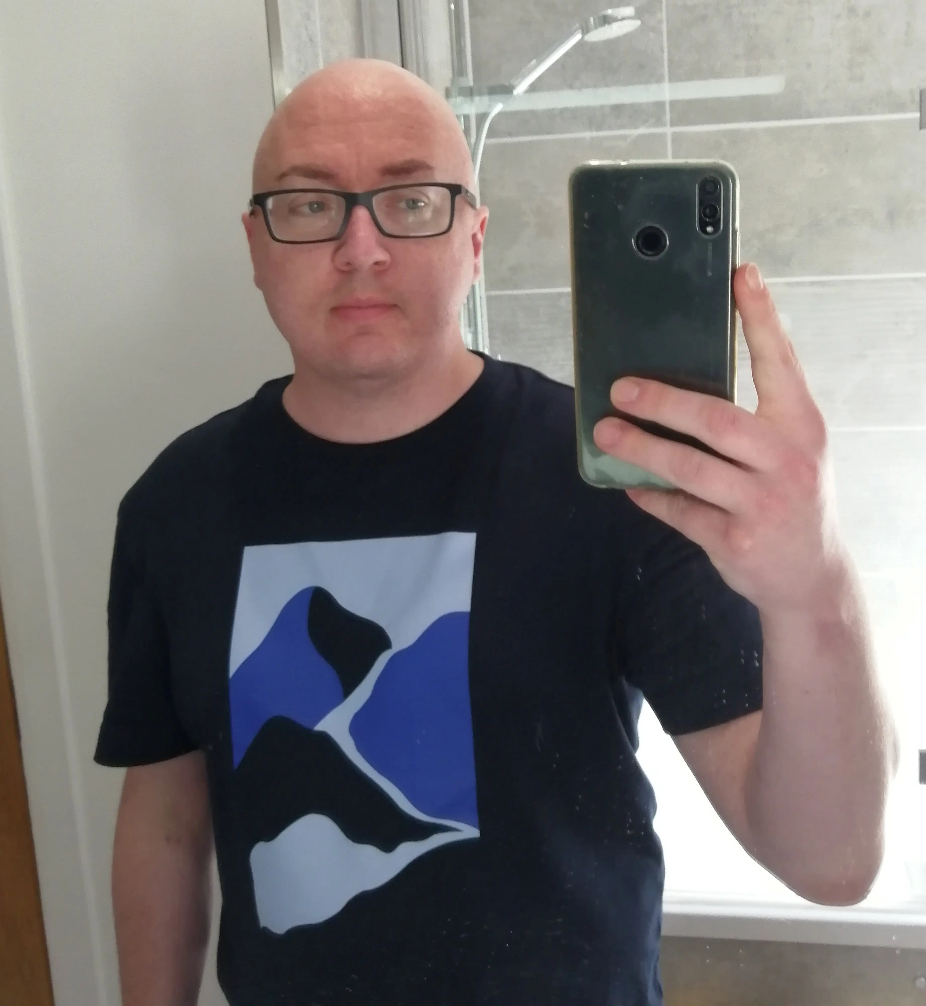 After surgery Craig could not speak or walk for a period of time (SWNS)