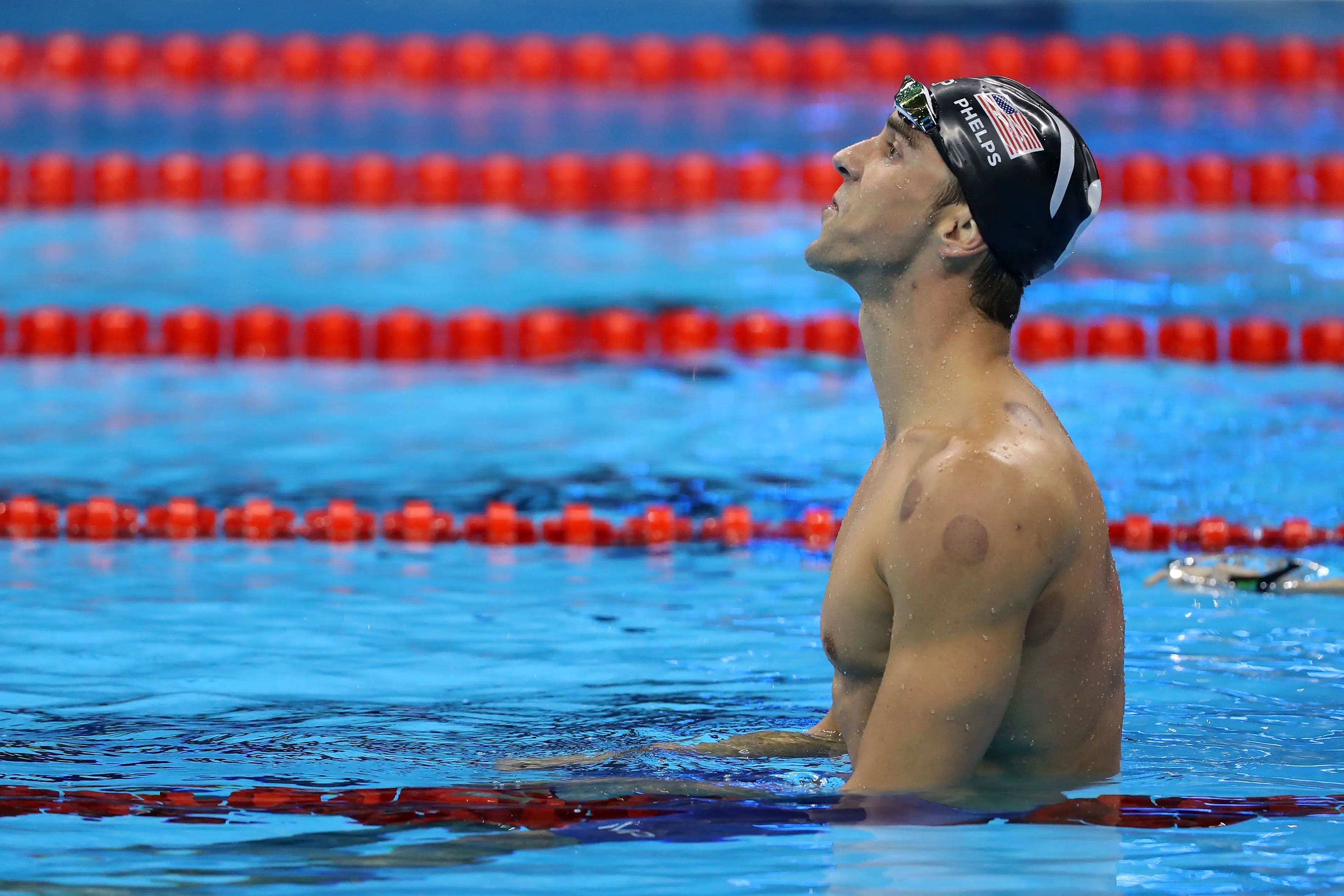 Michael Phelps seen with cupping therapy bruises on his shoulders. (Al Bello/Getty Images) 
