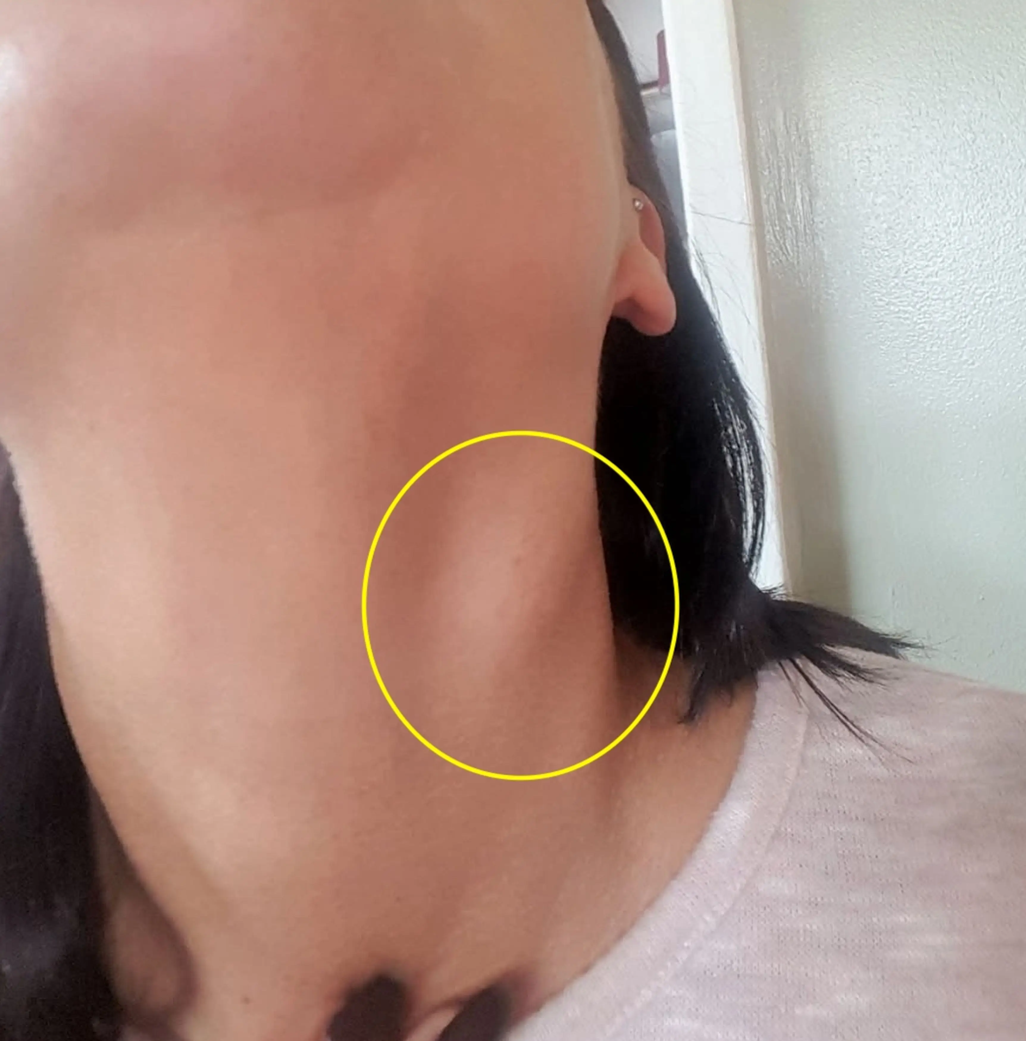The mom noticed an unexplained lump on her neck (Kennedy News and Media)