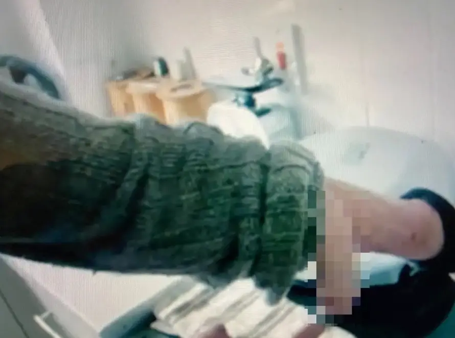 His penis fell off in 2015 after he suffered a blood infection.