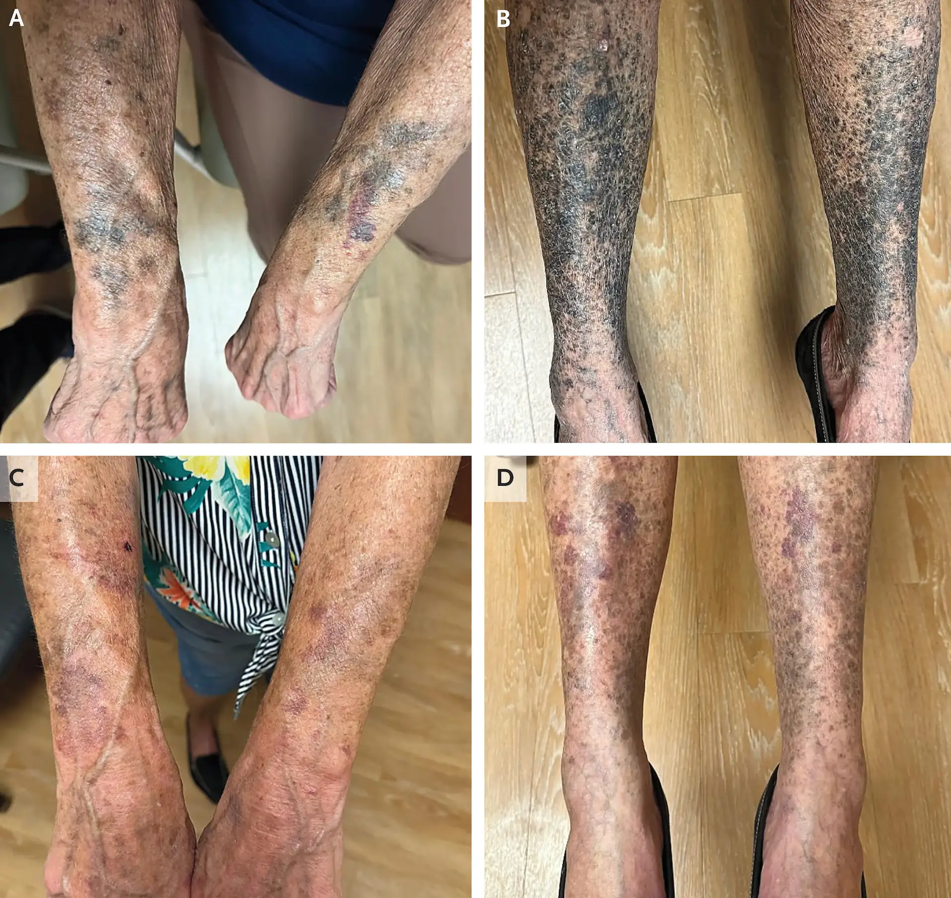 The condition is certainly rare (The New England Journal of Medicine)