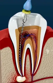 No no no no no no (YouTube / Medical Arts Official)