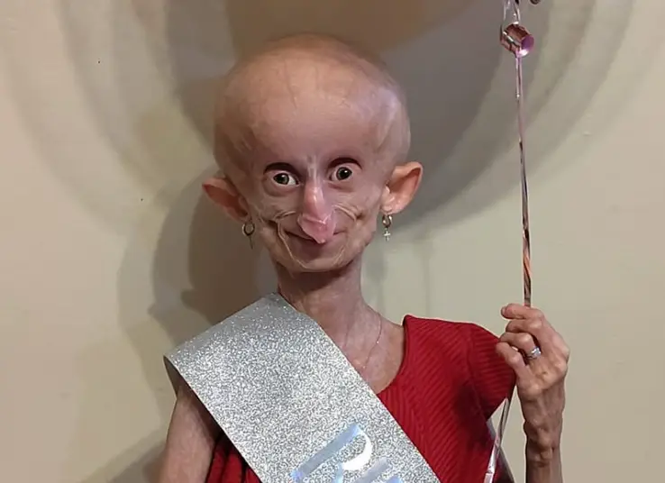 Beandri had turned 19 in November (Facebook/ Bea Booysen)