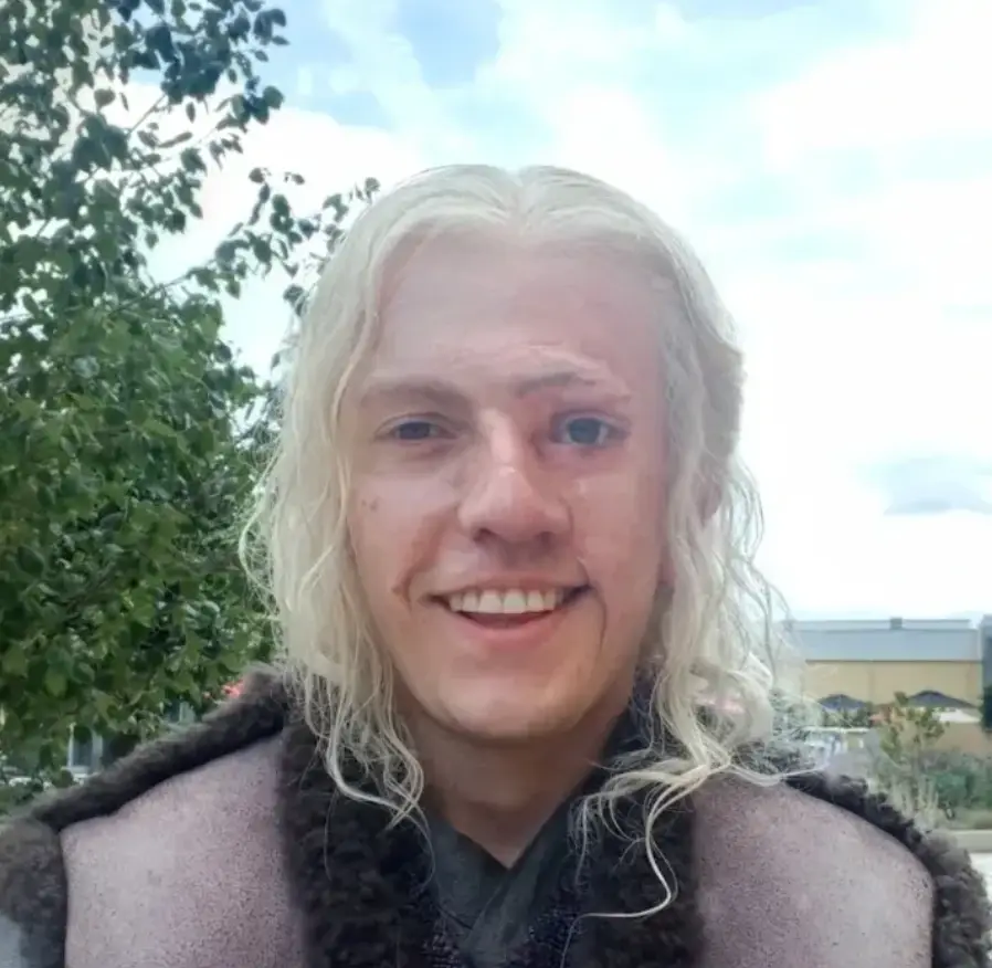 House of the Dragon star Robert Rhodes has taken to Twitter to raise awareness about the 'correct language' to use when it comes to talking about 'scarring' (Instagram/ @robert_rhodes160) 