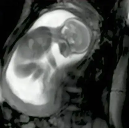 The scan, which reportedly took place in 2017, was recorded by the iFIND project, a London-based group of medical experts.