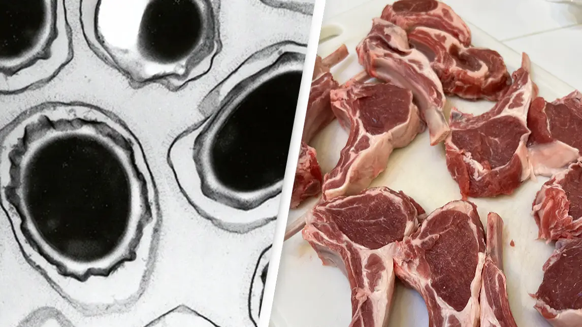 Anthrax Vaccine Immunization Program/Getty Images/Smith Collection/Gado/Getty Images