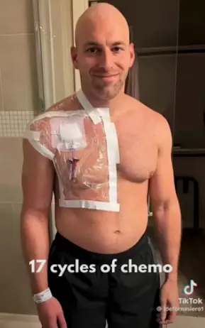 He had two major 10-hour surgeries (The Patient Story/YouTube)