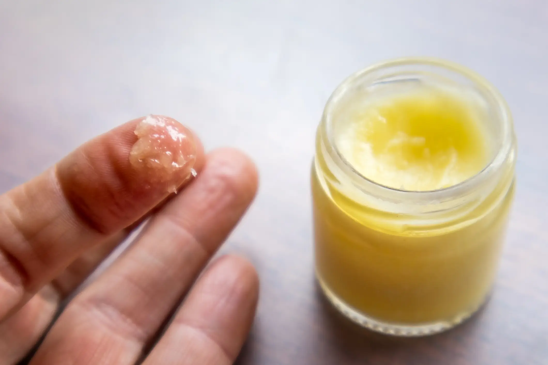 According to Doctor Emeka, an NHS doctor and author of Your Health in Your Hands, coconut oil does have real merits in certain situations. (Getty stock image)