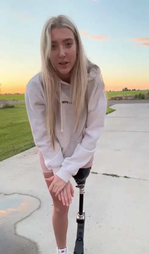 Kennedy had five amputations on her leg.