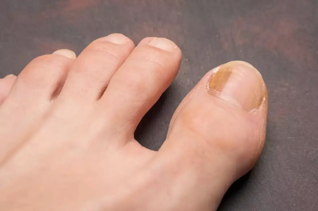 You should be checking your toenails (Getty Stock Photo)