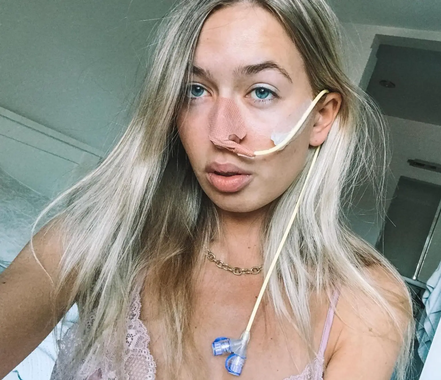 Anja Christoffersen was born with a rare condition. (Instagram/@anjachristoffersen)