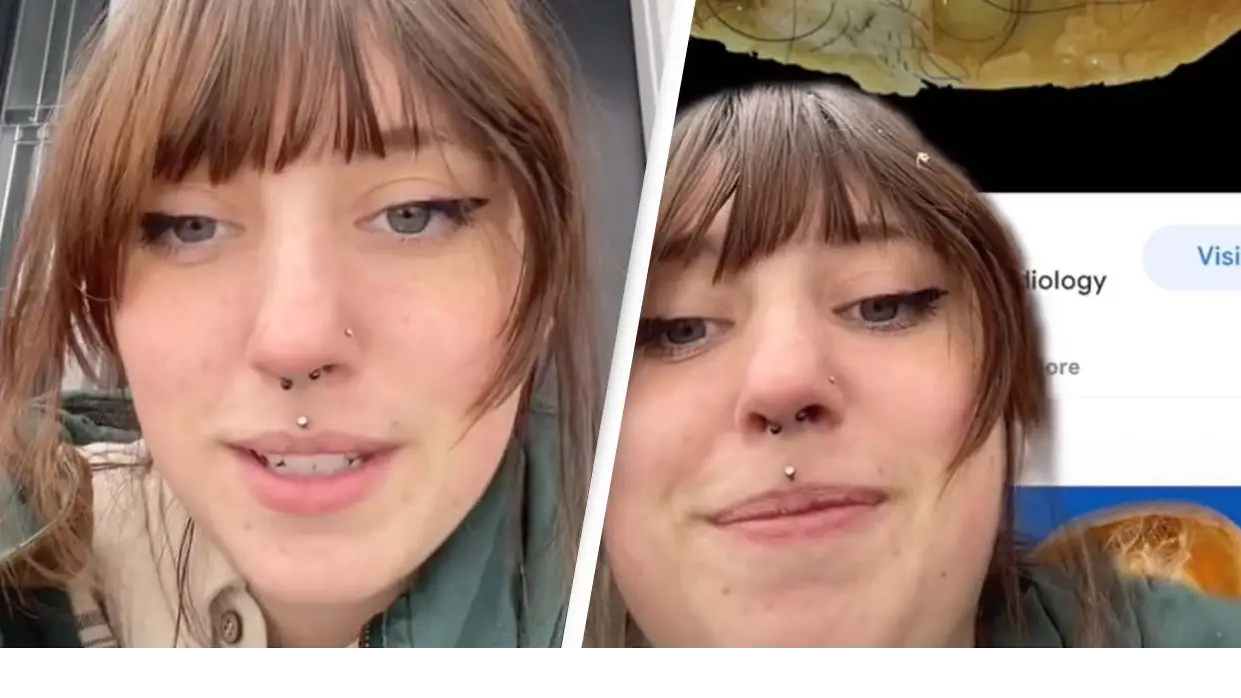 Woman's Ultrasound Reveals Hair And Teeth Were Growing In Her Uterus For Years