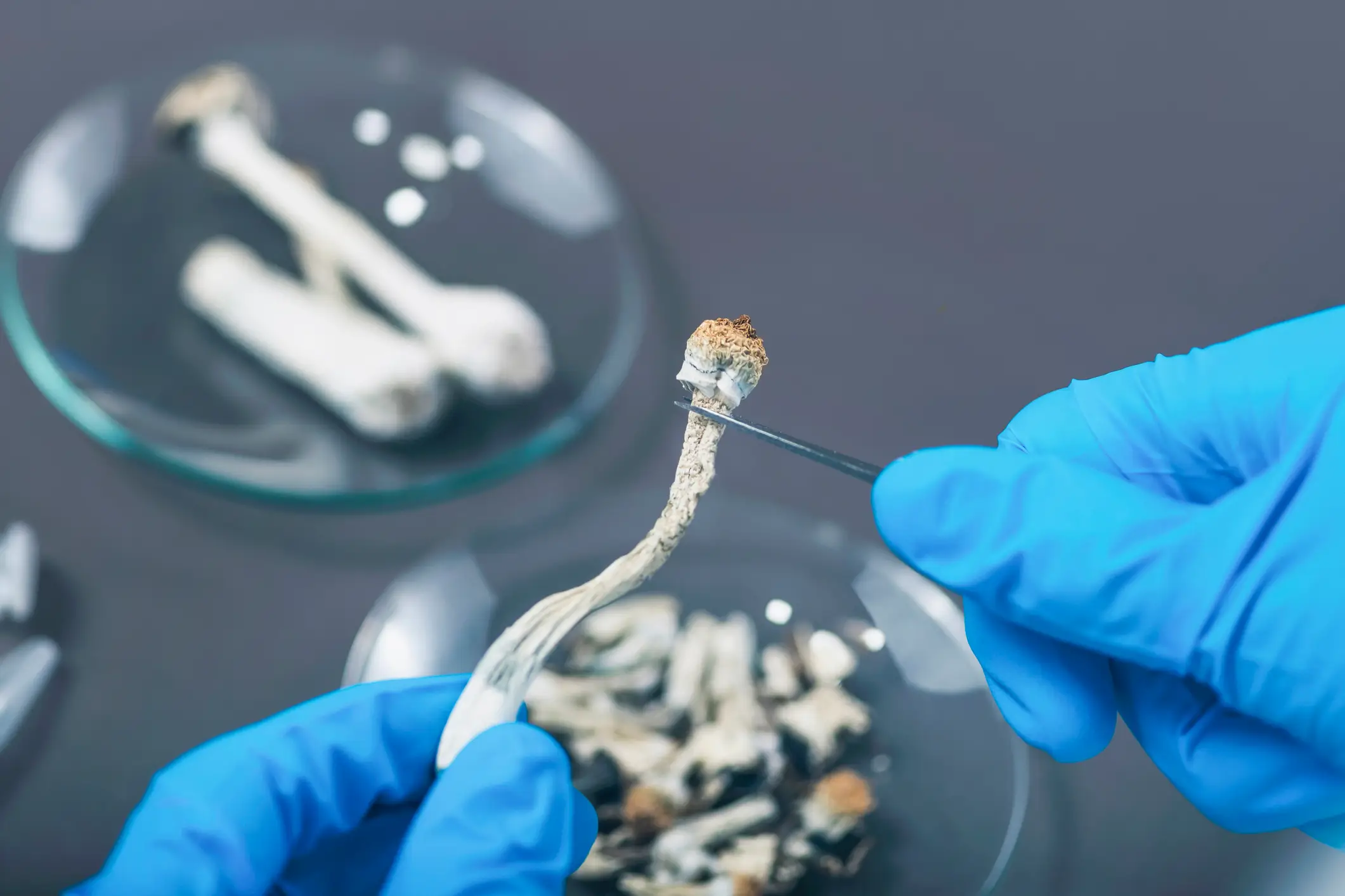 The psilocybin study is the first of its kind (Microgen Images/Science Photo Library/Getty Images)