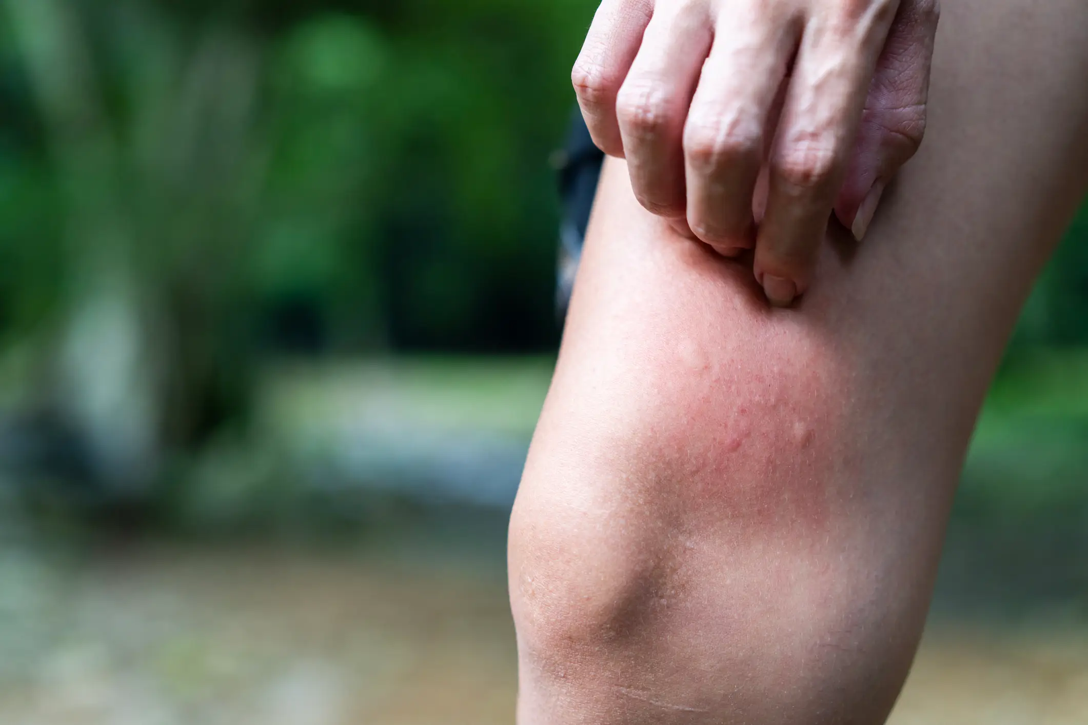 It makes them a lot worse (Getty Stock Images)