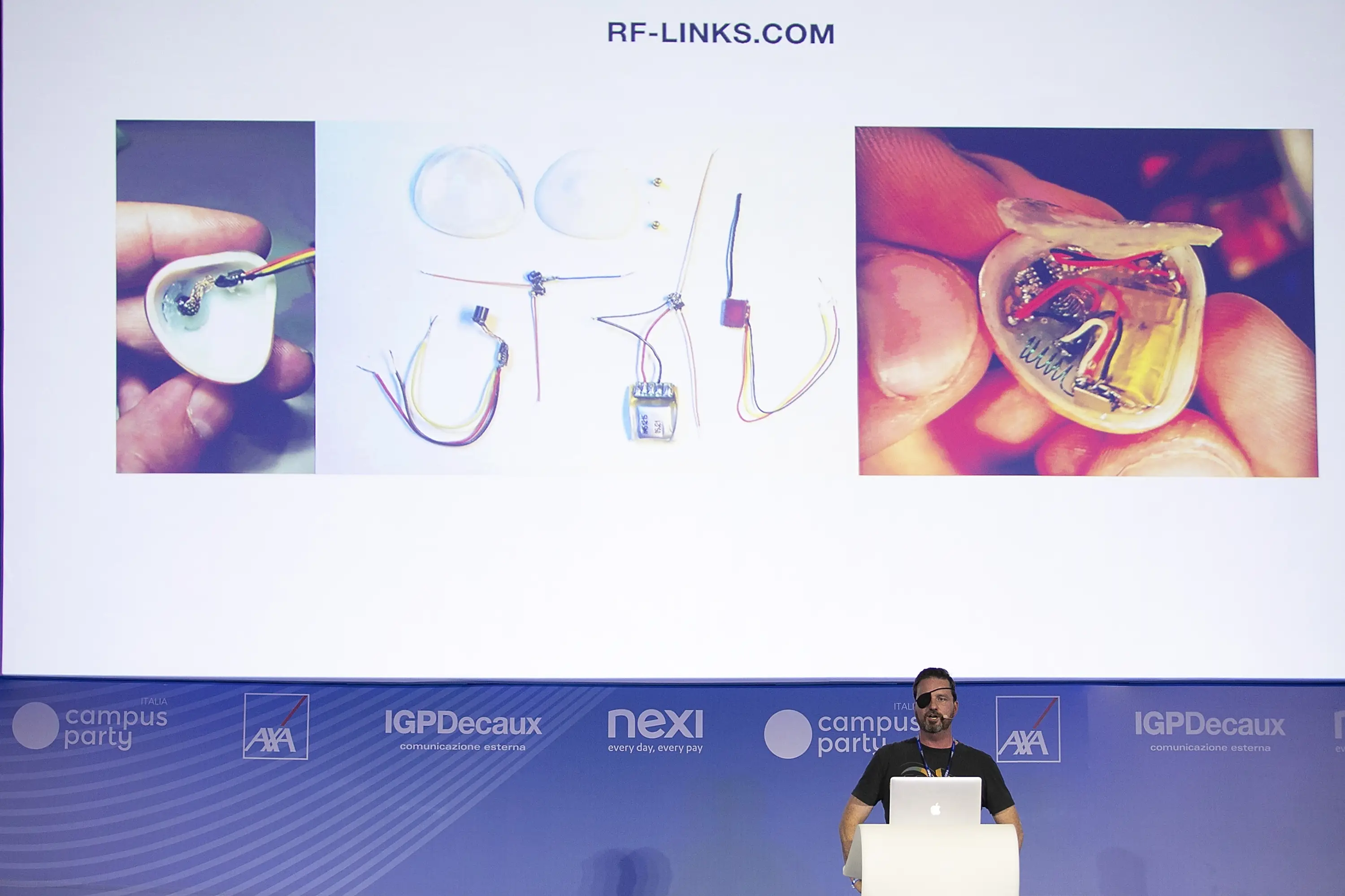 The device is filled with tiny pieces of tech. (Rosdiana Ciaravolo/Getty Images)