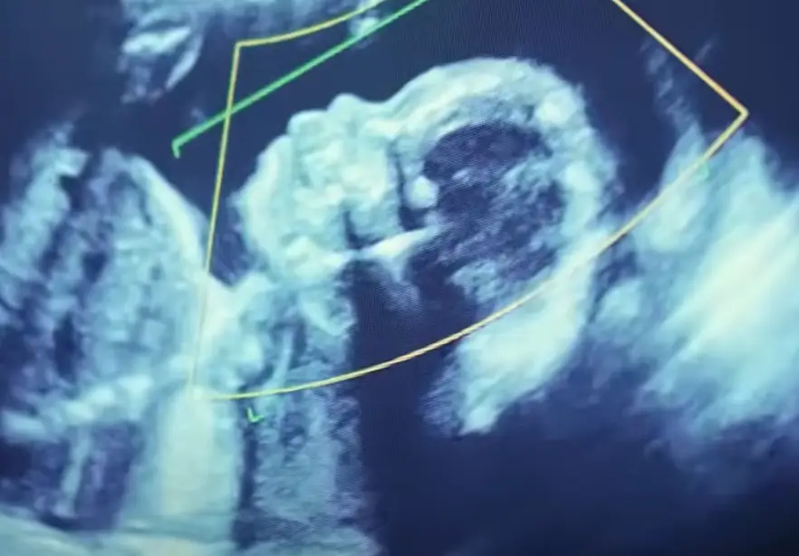 Some viewers suggested the sperm banks were to blame. (Netflix)