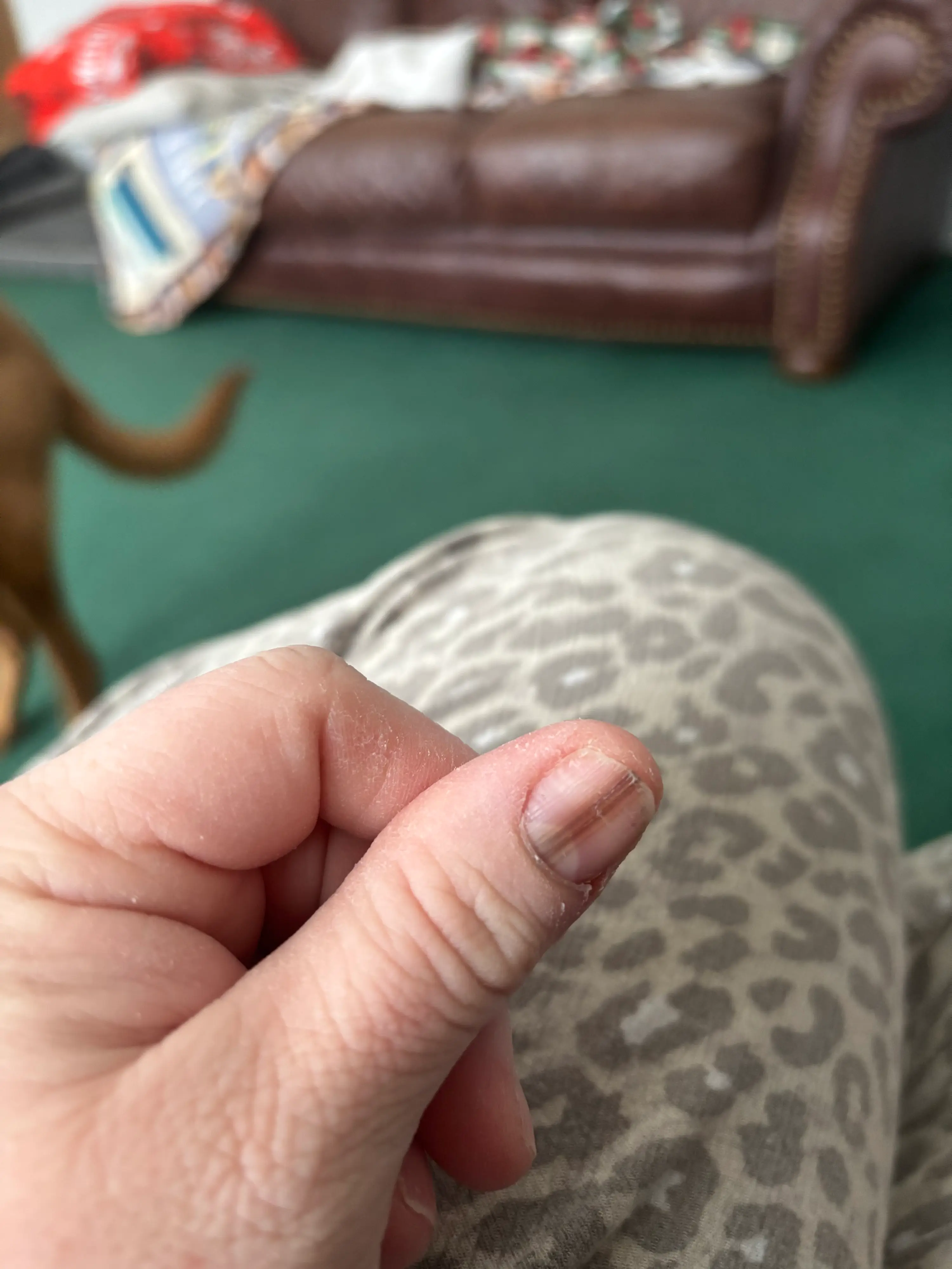 Thankfully the cancer was caught 'super early' (SWNS)