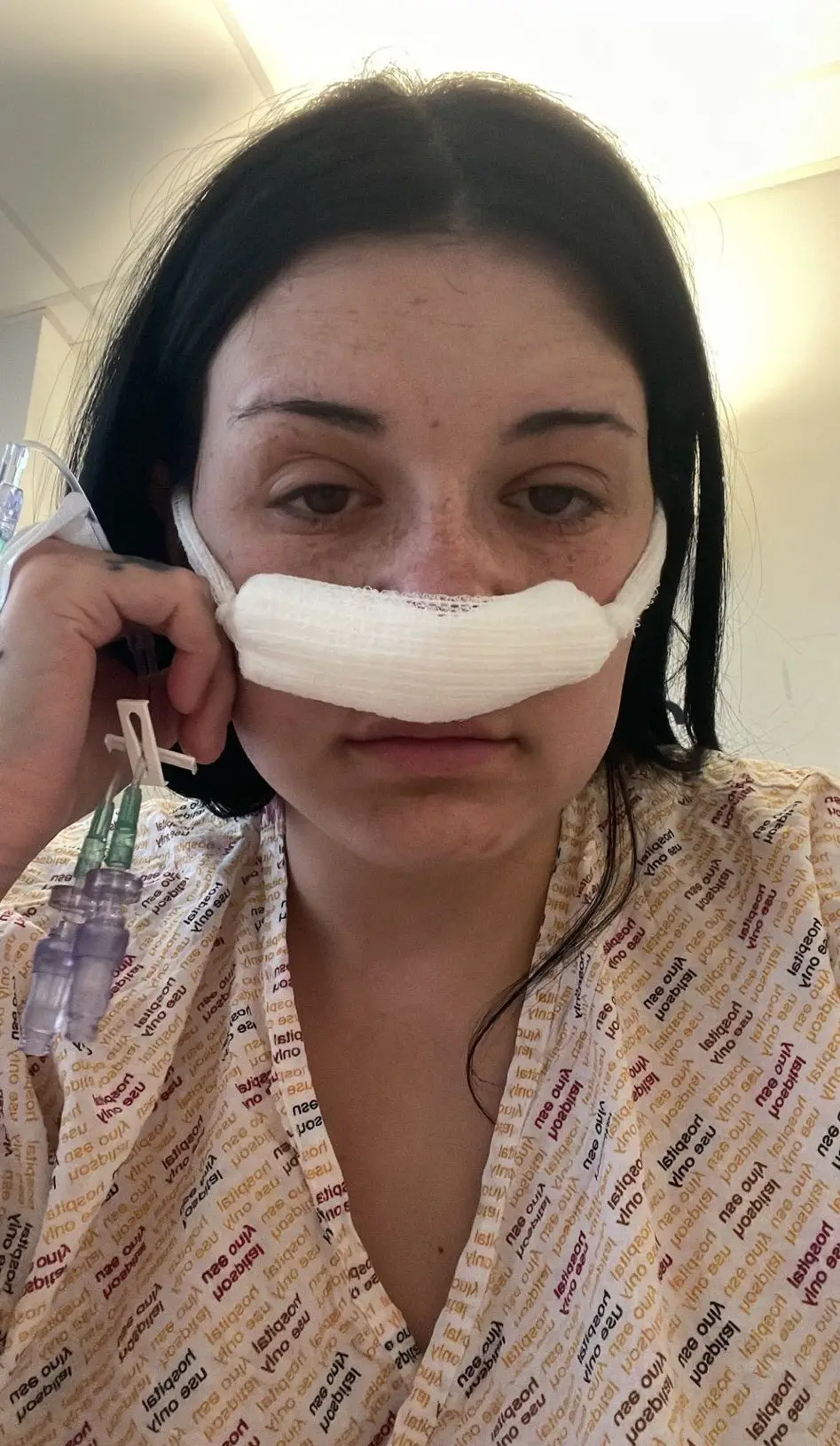 Libby had the tumor removed through her nose (SWNS)