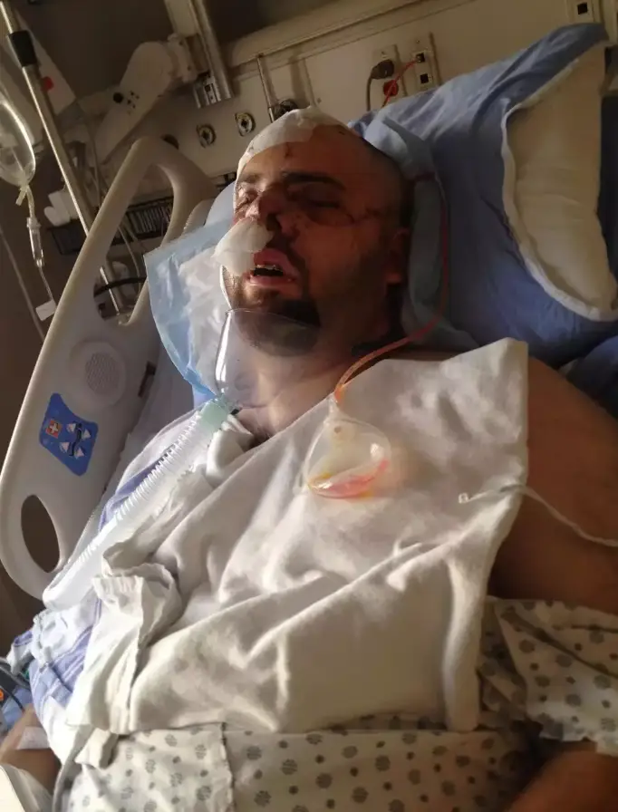 Jeremy Evans was badly injured by a grizzly bear (Supplied)