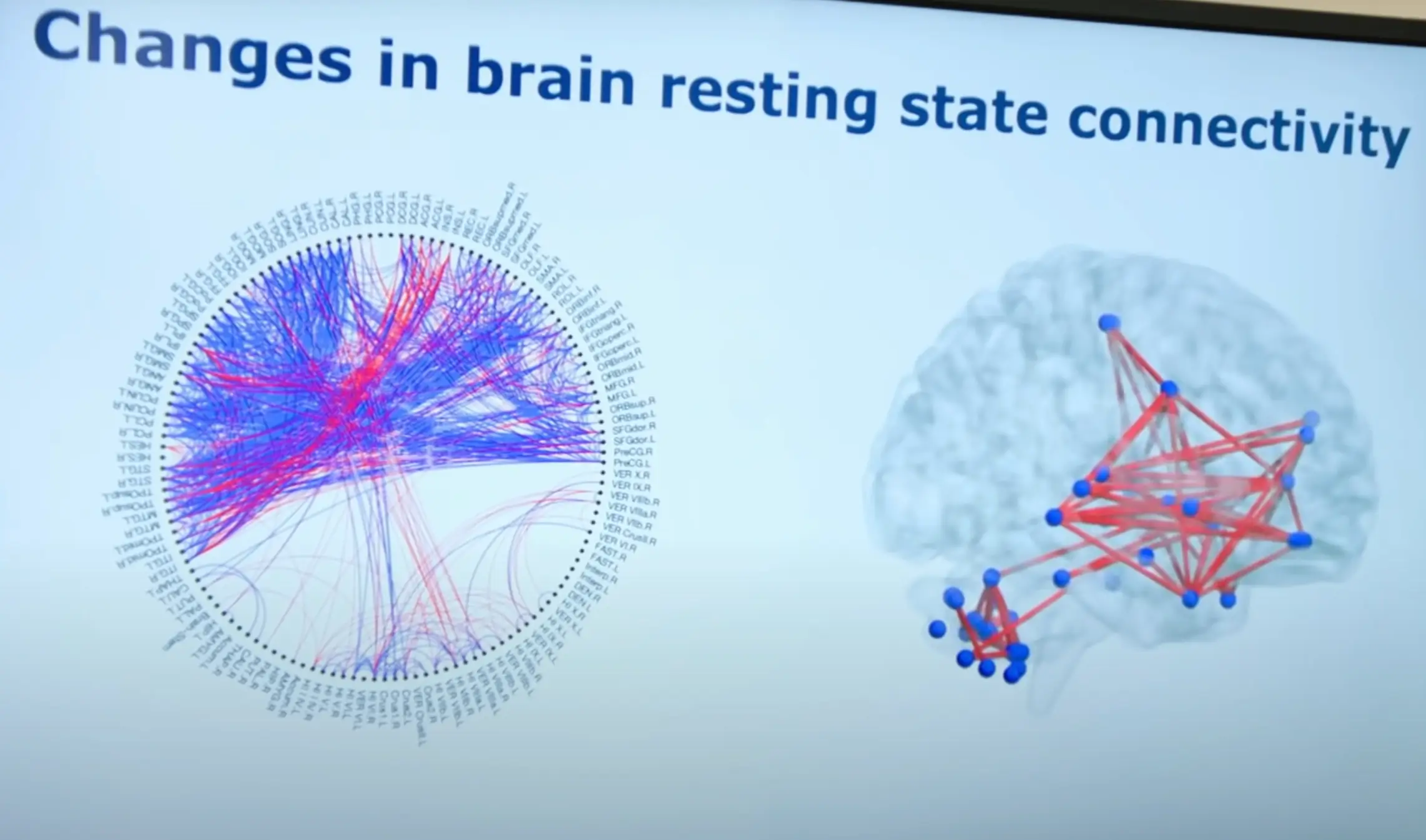 The results of his MRI scan left Dr Van Tulleken shocked as it revealed a large number of new functional connections had occurred in his brain (BBC)