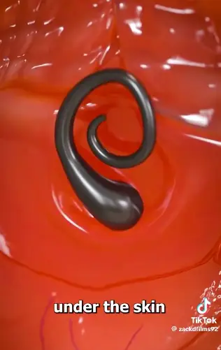 The simulation is enough to scar you from ever picking up a pair of tweezers again (TikTok/@zackdfilms92)