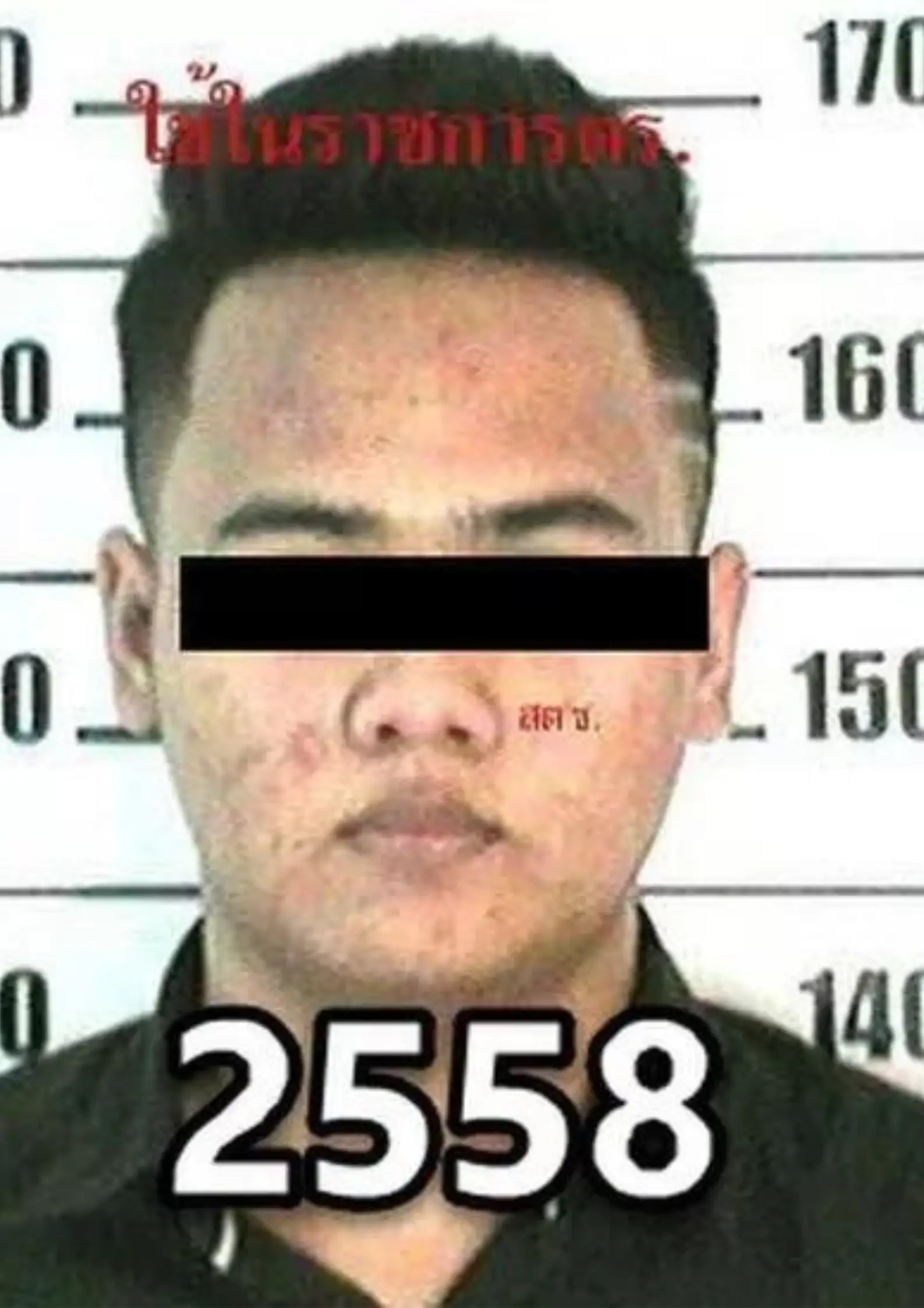 How Saharat Sawangjaeng looked before he underwent surgery.