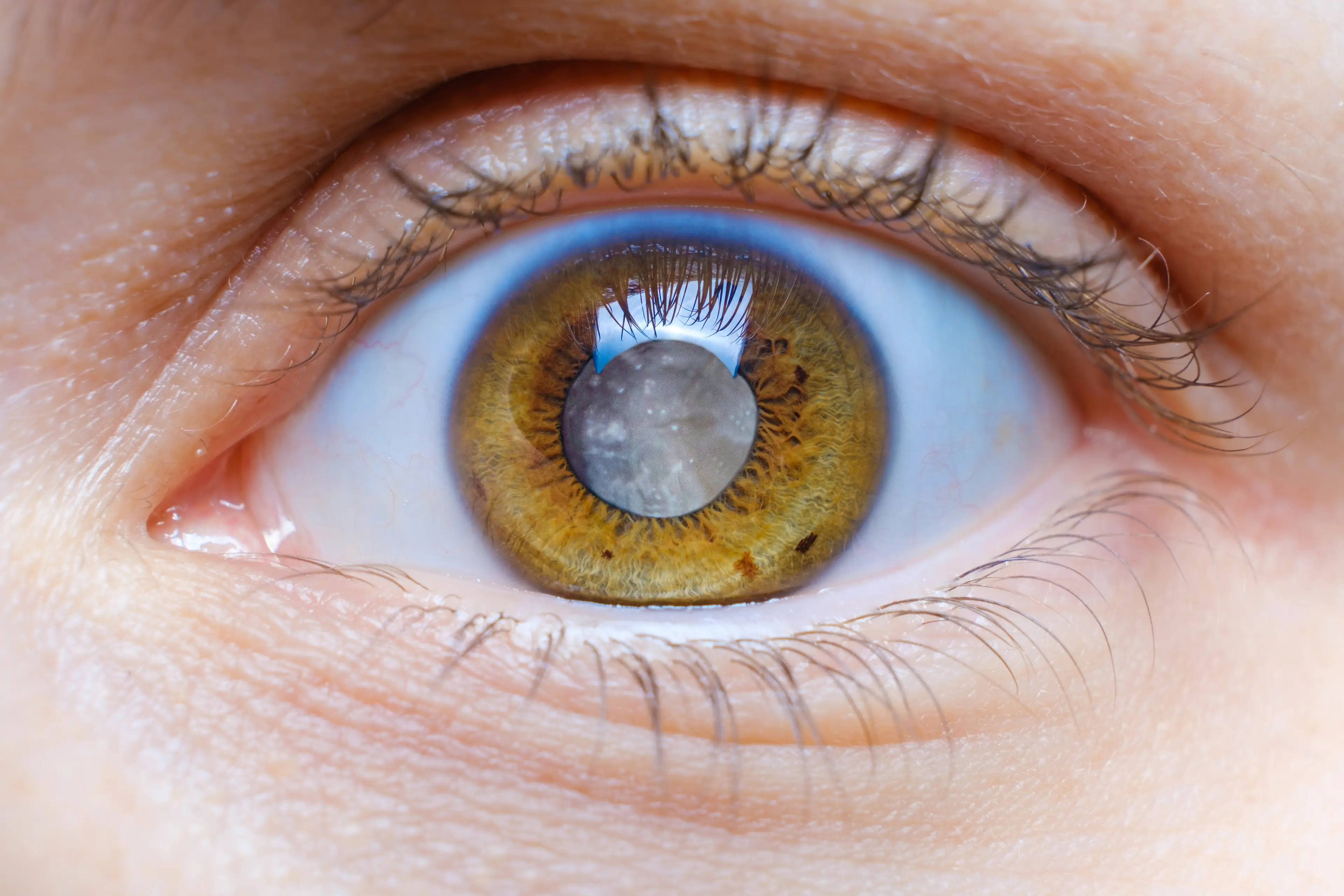 If you notice your vision getting cloudy, it may be time for a check up (Getty Stock Images/ Zarina Lukash) 