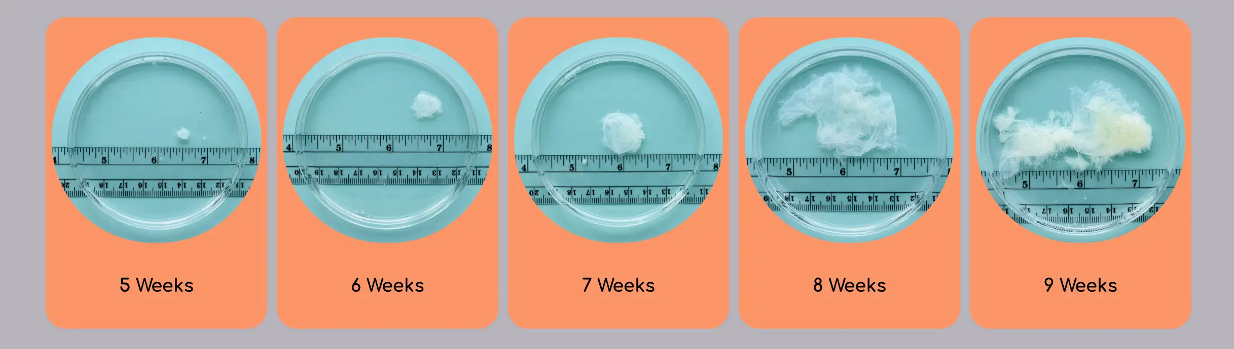 Dr Joan Fleischman reflected on how shocked people are when they see what the tissue really looks like.