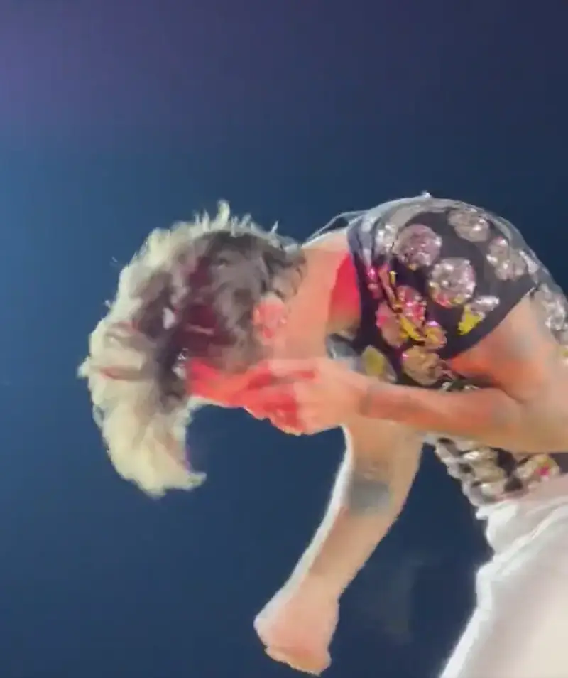 Harry appeared to be hit directly in the eye.