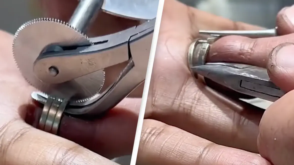 Woman gets rings removed from her finger after they were stuck for 15 years