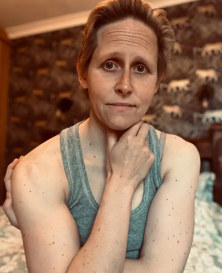 Charlie Anderson-Read was diagnosed with cancer at 38 (Instagram/mummy_againstcancer)