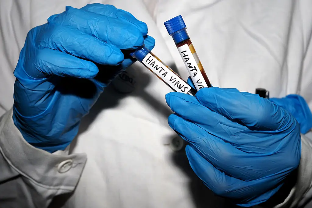 Passengers from the US are going through health screenings (Photo Illustration by Vincenzo Izzo/LightRocket via Getty Images)